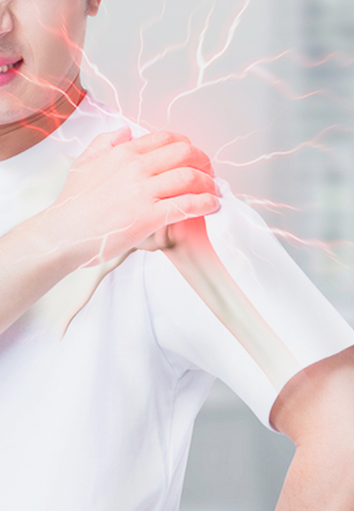 어깨충돌증후군